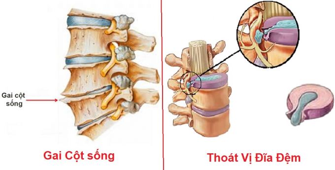 GAI COT SONG-THOAT VI DIA DEM