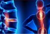 Viên xương khớp Vương Hoạt  Viên xương khớp Vương Hoạt