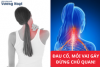 Mẹo giảm đau mỏi cổ vai gáy an toàn, hiệu quả ngay tại nhà!